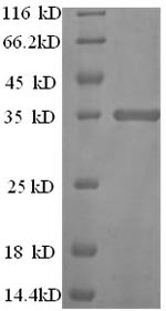 (Tris-Glycine gel) Discontinuous SDS-PAGE (reduced) with 5% enrichment gel and 15% separation gel.